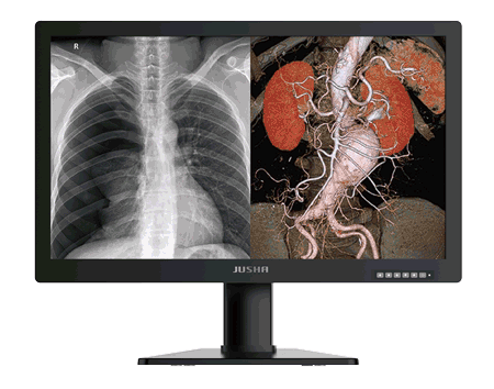 Jusha C820G 8MP Dicom Monitör jUSHA 8MP DICOM MONİTOR