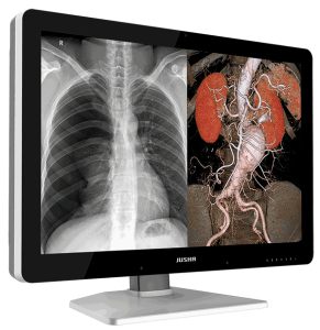 Jusha C660G Dicom Tanı Monitörü